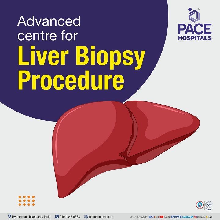Advanced Centre for Liver Biopsy in Hyderabad, India Best Hospital for liver biopsy procedure in Hyderabad, India