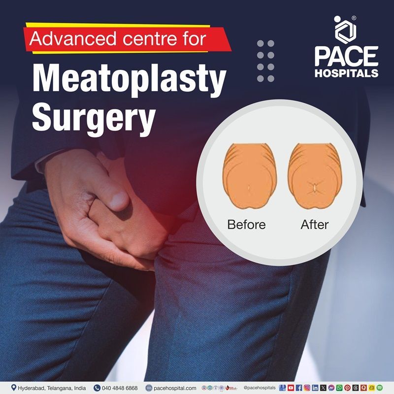 Advanced Centre for Meatoplasty Surgery in Hyderabad, India Meatoplasty Surgery in Hyderabad India | Meatoplasty Surgery near me | Best Hospital for Meatoplasty Surgery