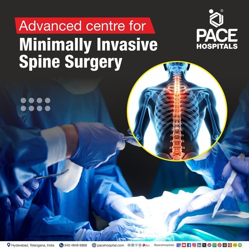 Advanced Centre for Minimally Invasive Spine Surgery (MISS) in Hyderabad, India Best Hospital for Minimally Invasive Spine Surgery in Hyderabad, India