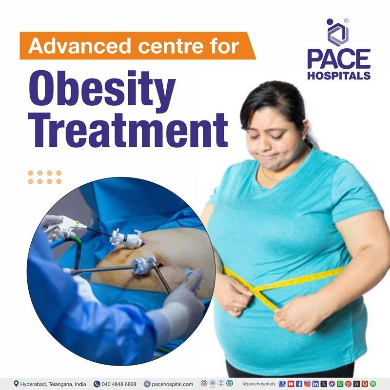 Advanced Centre for Obesity Treatment in Hyderabad, Telangana, India Best Obesity hospital in Hyderabad, India, best hospital for Obesity Treatment in Hyderabad, best hospital for childhood & Morbid obesity treatment in Hyderabad