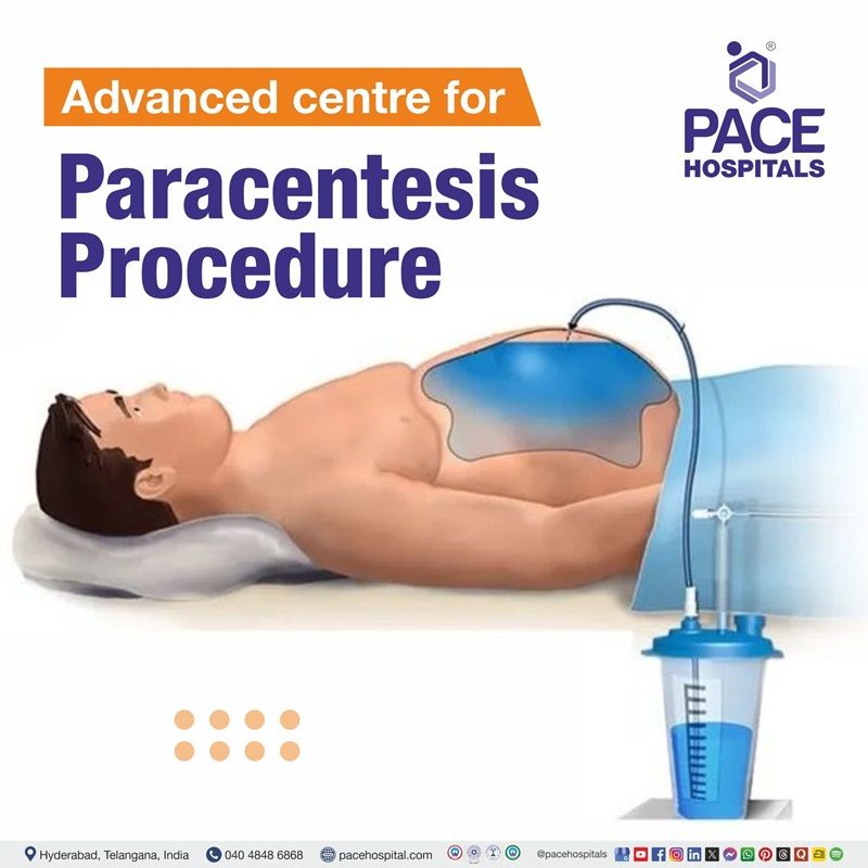 Leading Centre for Paracentesis Procedure in Hyderabad, India Best hospital for Paracentesis in Hyderabad, India | Abdominal fluid removal in Hyderabad