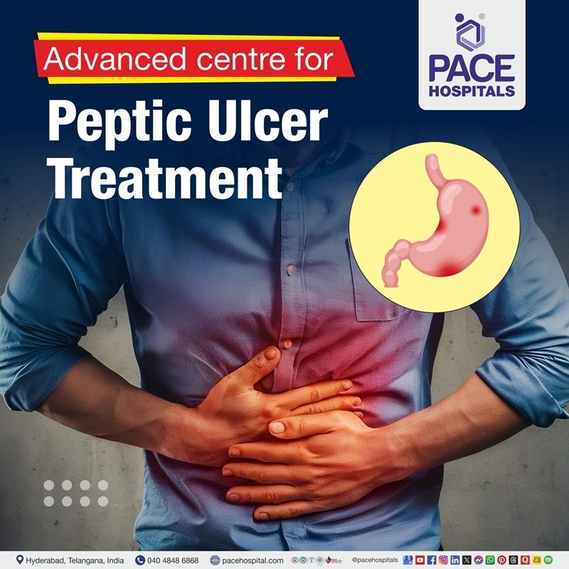 Advanced Centre for Peptic Ulcer Treatment in Hyderabad, India Best hospital for Peptic ulcer diagnosis | Peptic ulcer treatment in Hyderabad | Peptic ulcer treatment near me