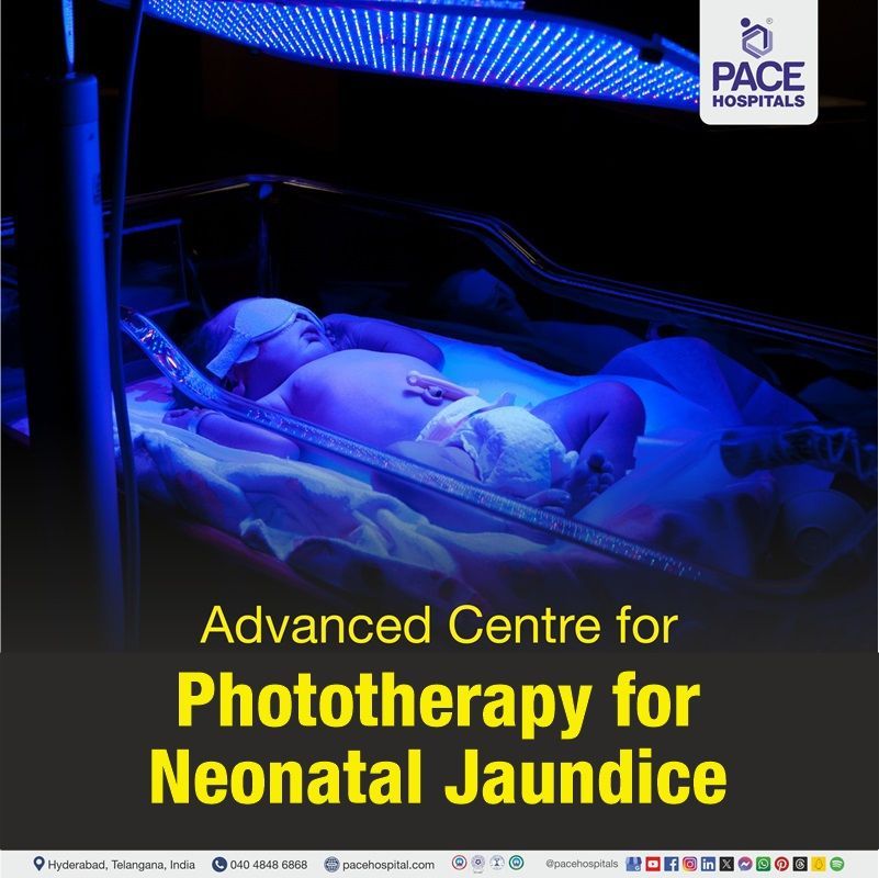 Advanced Centre Phototherapy Treatment for Neonatal Jaundice in Hyderabad, India best hospital for phototherapy treatment for jaundice in newborn in Hyderabad | phototherapy for neonatal jaundice in Hyderabad | phototherapy near me for neonatal jaundice