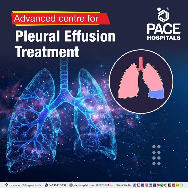 Advanced Centre for Pleural Effusion Treatment in Hyderabad, India Pleural effusion treatment hospital in Hyderabad | Top hospital for pleural effusion treatment in Hyderabad, India