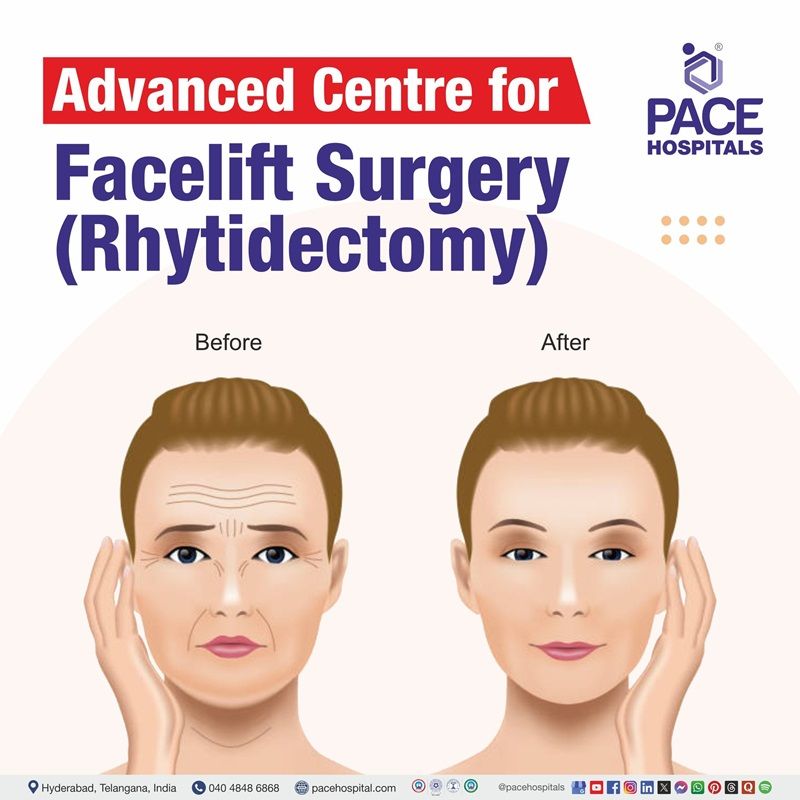 Best hospital for Face lift surgery in Hyderabad | Best Hospital for Rhytidectomy in Hyderabad