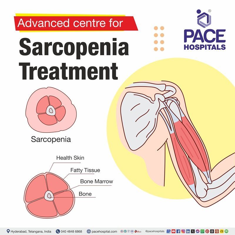 Advanced Centre for Sarcopenia Treatment Treatment in Hyderabad, India Top hospital for Sarcopenia treatment in Hyderabad, India | Sarcopenia Treatment near me