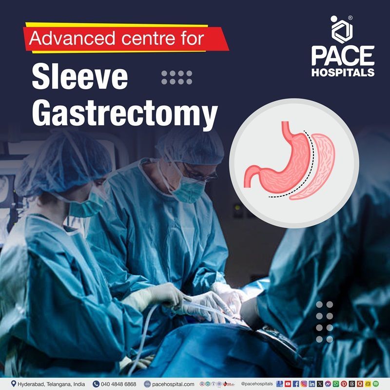 Leading Centre for Vertical Sleeve Gastrectomy Surgery in Hyderabad, Telangana, India Best Hospital for sleeve gastrectomy in Hyderabad | Advanced center for laparoscopic sleeve gastrectomy in Hyderabad, India