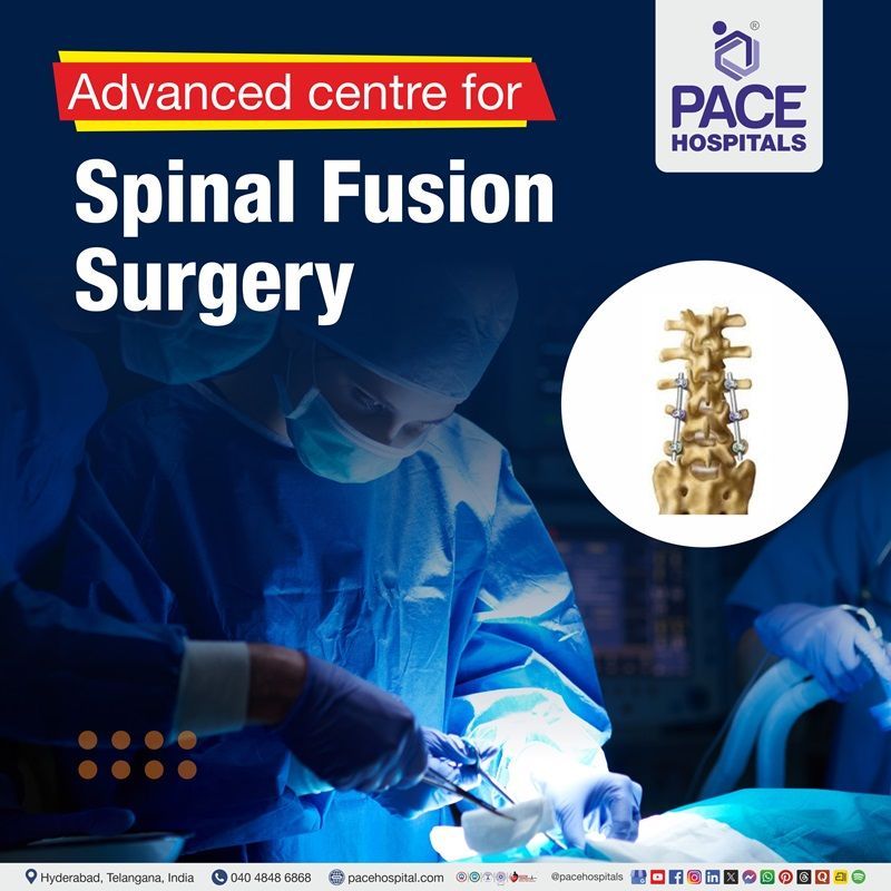 Best Hospital for Spinal Fusion Surgery in Hyderabad, India Hospital for Spinal fusion surgery in Hyderabad, India | Spine care Hospital in Hyderabad, India
