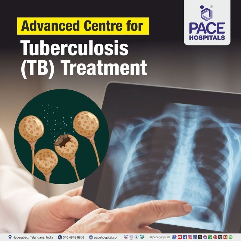 Best Hospital for Tuberculosis (TB) Treatment in Hyderabad, Telangana, India Best TB Hospital in Hyderabad, Telangana | Best Hospitals in Hyderabad for Tuberculosis TB Treatment
