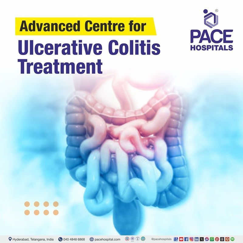 Advanced Centre for Ulcerative Colitis Treatment in Hyderabad, Telangana, India Best hospitals for Ulcerative Colitis Treatment in Hyderabad, India | Ulcerative Colitis Treatment Hospital in Hyderabad, India