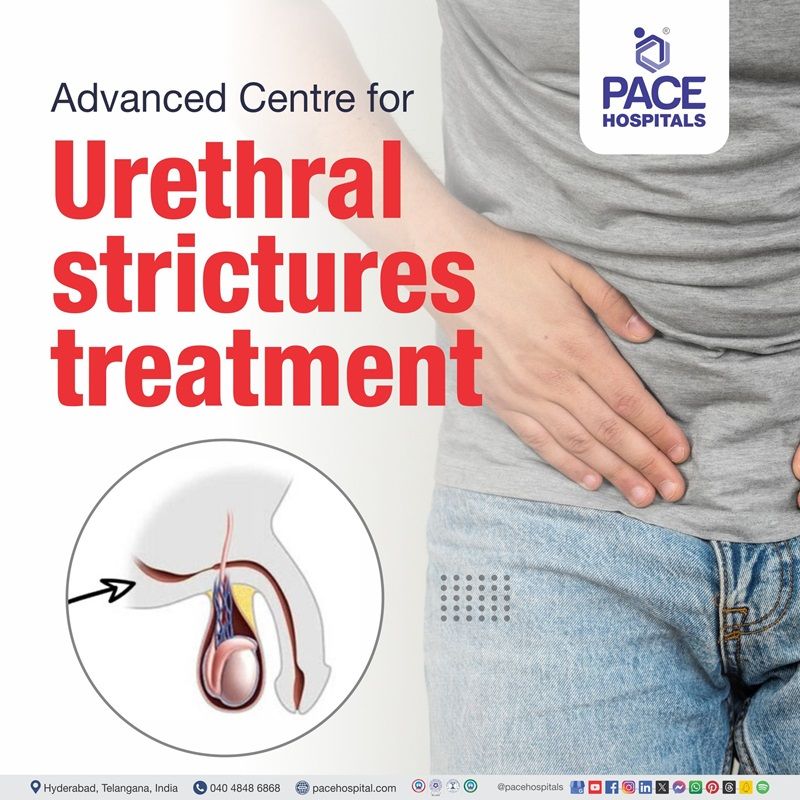 Advanced Centre for Urethral Stricture Treatment in Hyderabad, India best hospital urethral stricture treatment in Hyderabad | best treatment for Urethral Stricture in Hyderabad, India