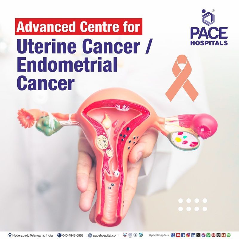 Best Uterine & Endometrial Cancer Treatment Hospital in Hyderabad Best hospital for Uterine & Endometrial Cancer Treatment in Hyderabad, India | Uterine & Endometrial Cancer Treatment in Hyderabad | best Uterine & Endometrial Cancer Treatment Hospital in India