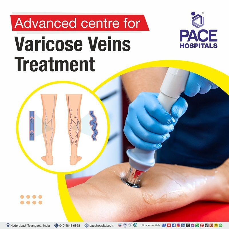 Best Hospital for Varicose Veins Treatment in Hyderabad, India Best Hospital for varicose veins Treatment in Hyderabad | varicose veins hospital in Hyderabad, India
