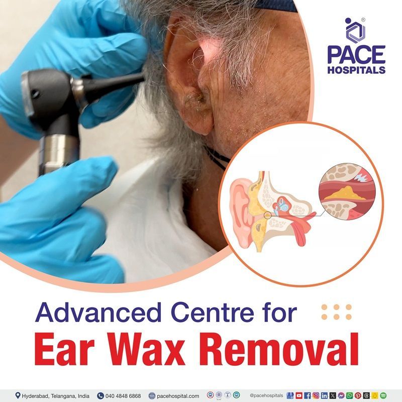 Ear Wax Removal Hospital in Hyderabad, India Best ear wax removal hospital in Hyderabad, India | ear wax removal clinic near me | ear wax clinic near me | ear wax removal cost in Hyderabad