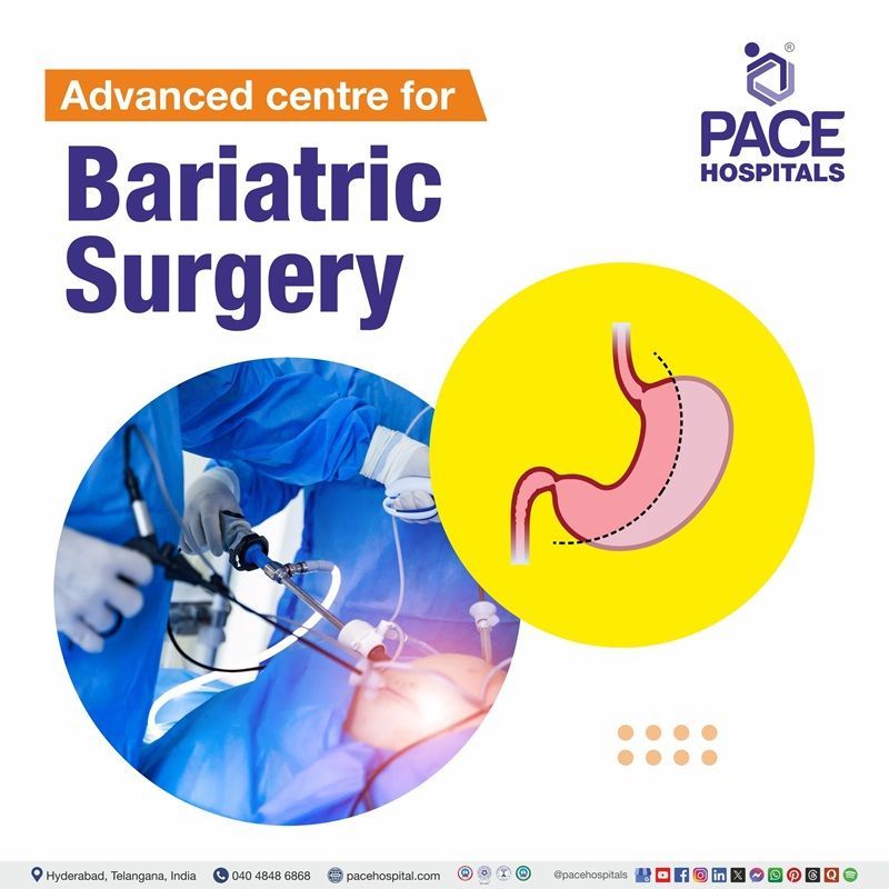 Leading Centre for Bariatric Surgery in Hyderabad, India Best hospital for bariatric surgery in Hyderabad | bariatric surgery before and after