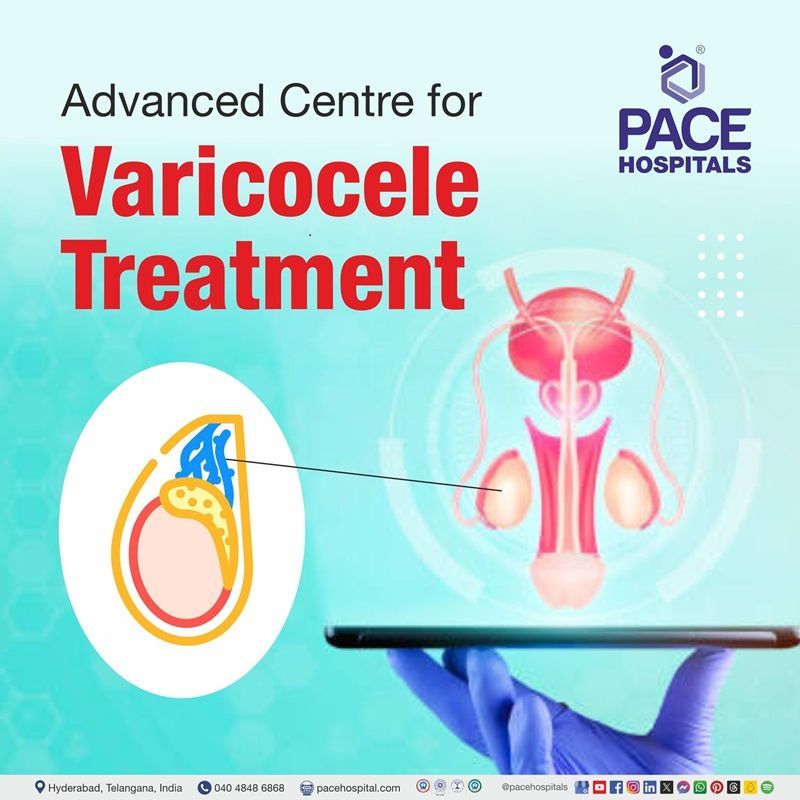 Advanced Centre for Varicocele Treatment in Hyderabad, India Best Hospital for varicocele treatment in Hyderabad India | varicocele treatment cost in Hyderabad | varicocele treatment hospitals in Hyderabad | varicocele treatment without surgery | varicocele treatment near me