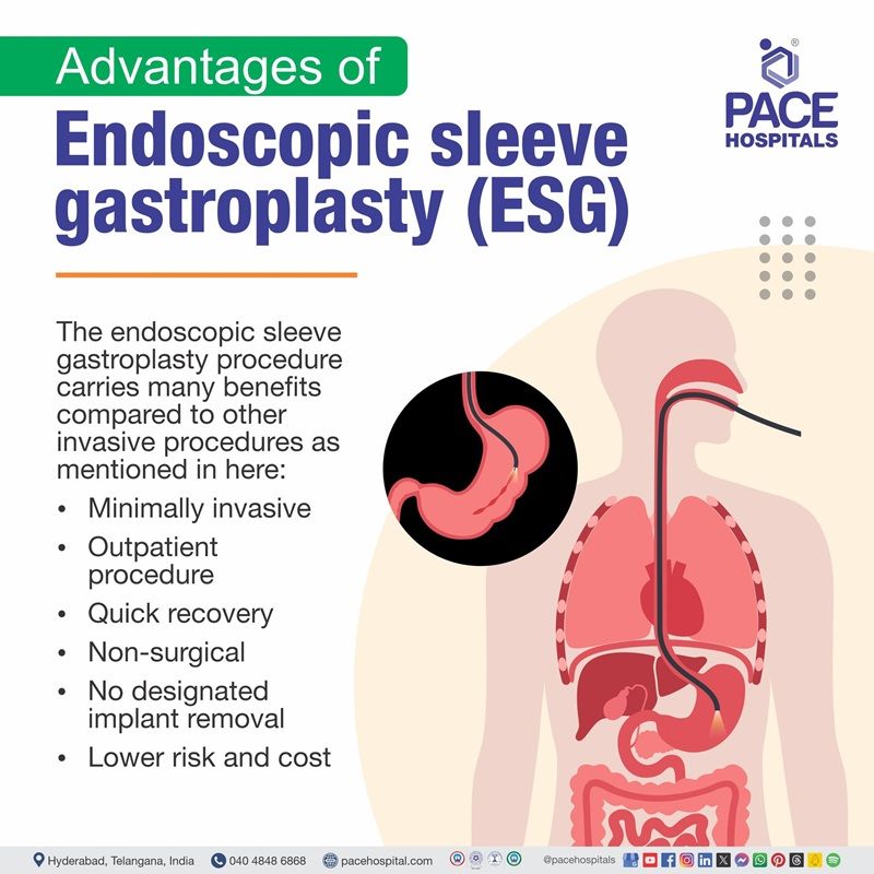 Advantages of Endoscopic Sleeve Gastroplasty (ESG) endoscopic sleeve gastroplasty advantages | endoscopic sleeve gastroplasty weight loss | endoscopic sleeve gastroplasty locations