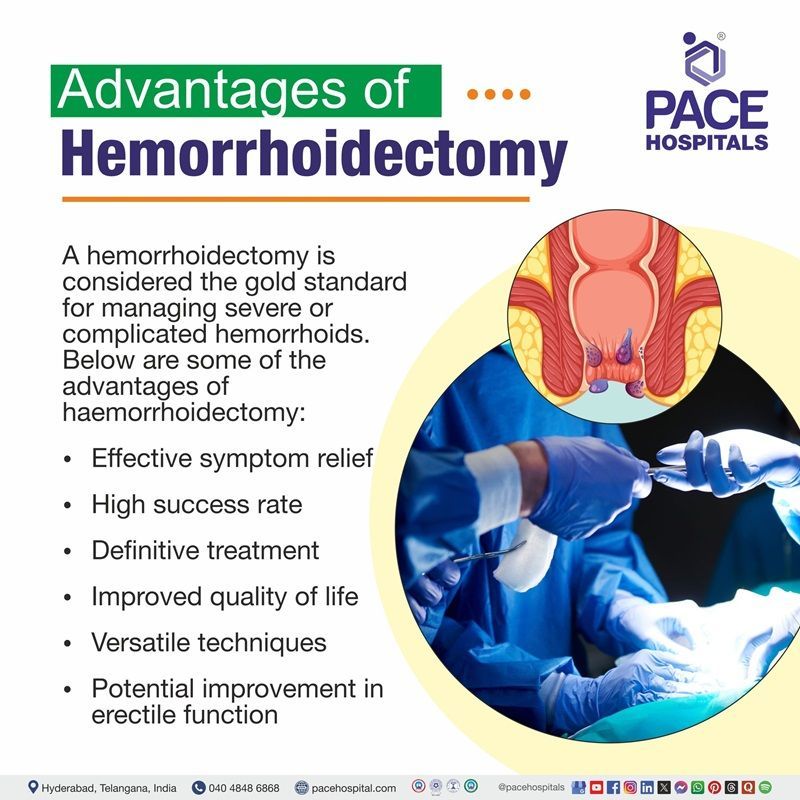 Advantages of Hemorrhoidectomy Procedure Hemorrhoidectomy advantages |
Advantages of Hemorrhoidectomy