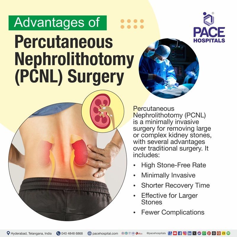 Illustration of PCNL procedure advantages and kidney stone removal | PCNL Surgery Benefits