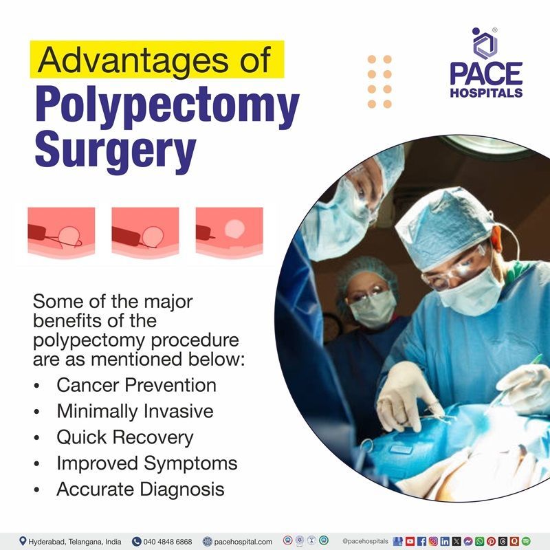 Advantages of Polypectomy Procedure Advantages of colonoscopic polypectomy, nasal polypectomy, rectal polypectomy, colonoscopy with snare polypectomy