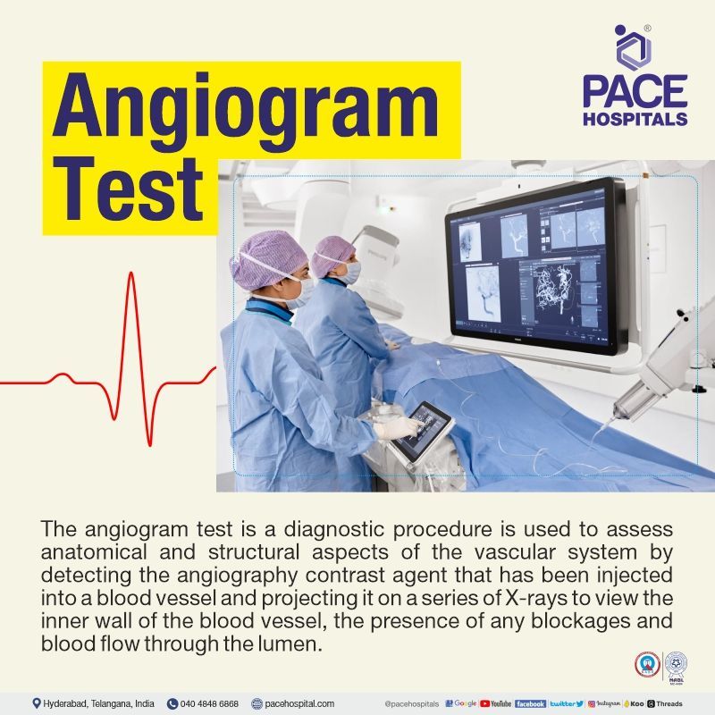 Best hospital in Hyderabad for angiogram procedure angiogram cost in hyderabad | best cardiac hospital for angiogram test in hyderabad | angiography price in hyderabad, telangana, india