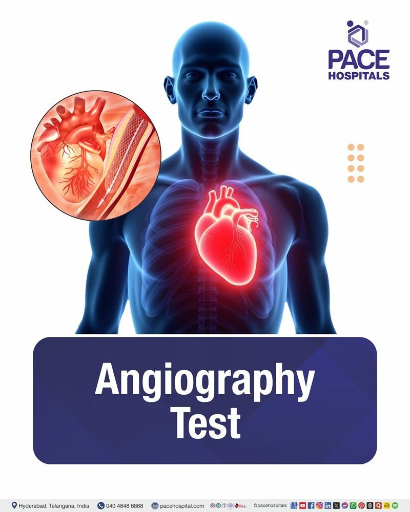 Angiography test Cost in Hyderabad | Affordable angiogram in India