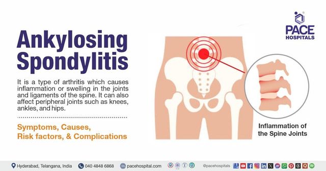 glp 1 ankylosing spondylitis Doctor discusses micro dosing GLP-1 for Ankylosing Spondylitis - New