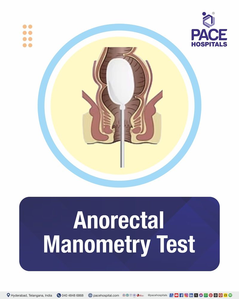 Anorectal Manometry Test Cost in Hyderabad | Affordable Anorectal Manometry in India