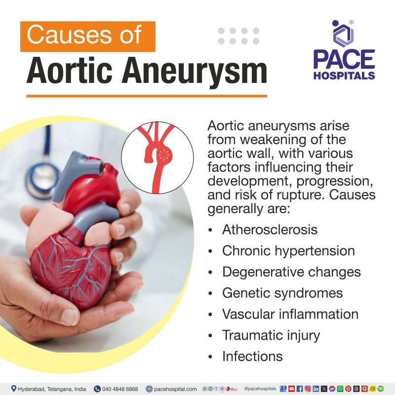 Aortic Aneurysm Causes Aortic Aneurysm Causes | Most common cause of aortic aneurysm | Causes of Aortic Aneurysm