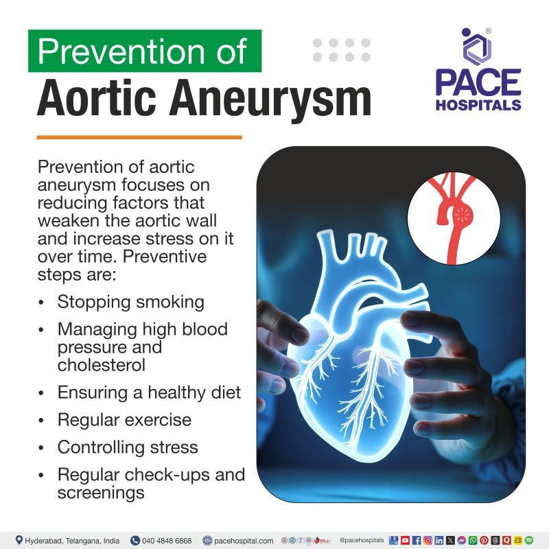 Aortic Aneurysm Prevention Aortic Aneurysm Prevention | How to prevent aortic aneurysm