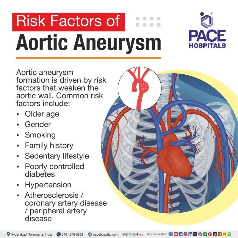 Aortic Aneurysm Risk Factors Aortic Aneurysm Risk Factors | Risk factors for Aortic Aneurysm