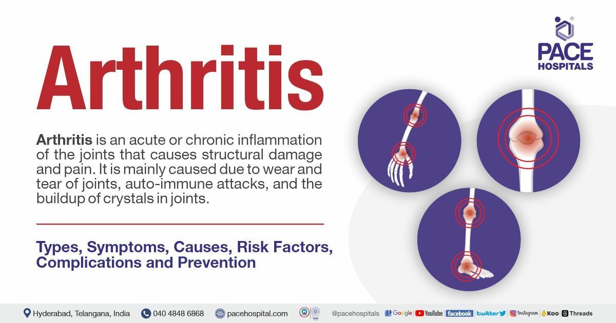 Arthritis disease: Symptoms, Types, Causes, Risk Factors, Complications, Prevention