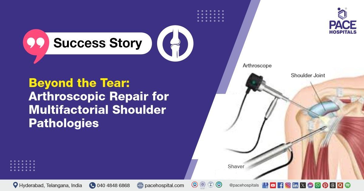 Case study of a 66-y/o man treated at PACE Hospitals for rotator cuff tear & biceps tendinitis