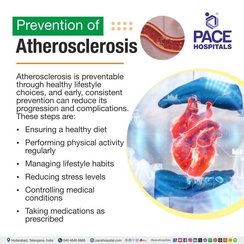 Atherosclerosis Prevention Atherosclerosis Prevention | Primary prevention of atherosclerosis | Atherosclerosis prevention and control