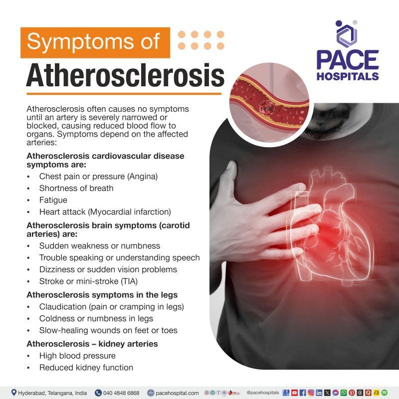 Atherosclerosis Symptoms Atherosclerosis Symptoms | Signs and symptoms of atherosclerosis