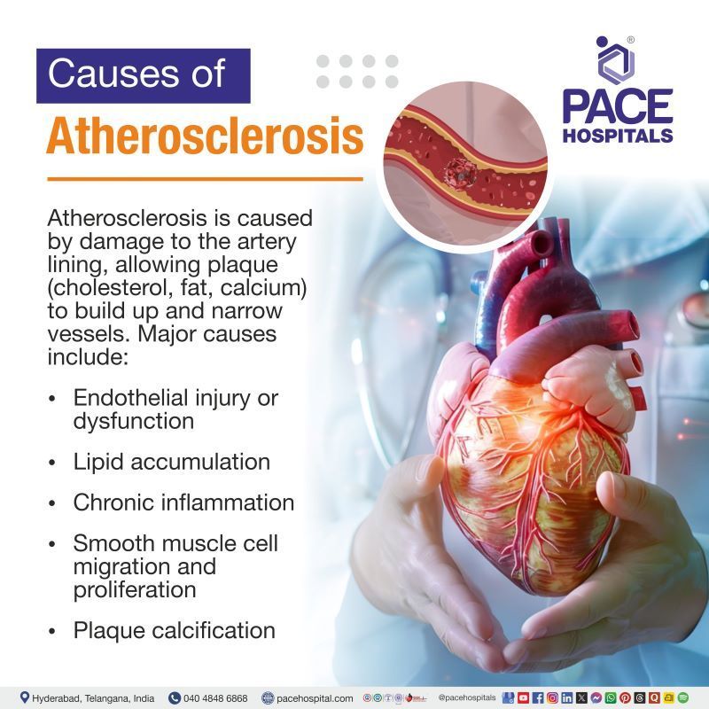 Atherosclerosis Causes Atherosclerosis Causes | What causes atherosclerosis