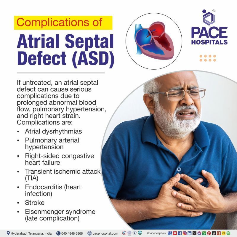 ASD Complications ASD Complications | Atrial septal defect complications