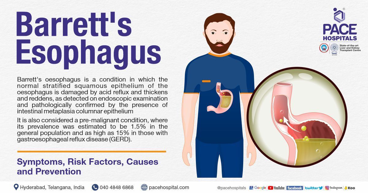 Barrett's esophagus – Symptoms, Causes, Types, Complications and Prevention