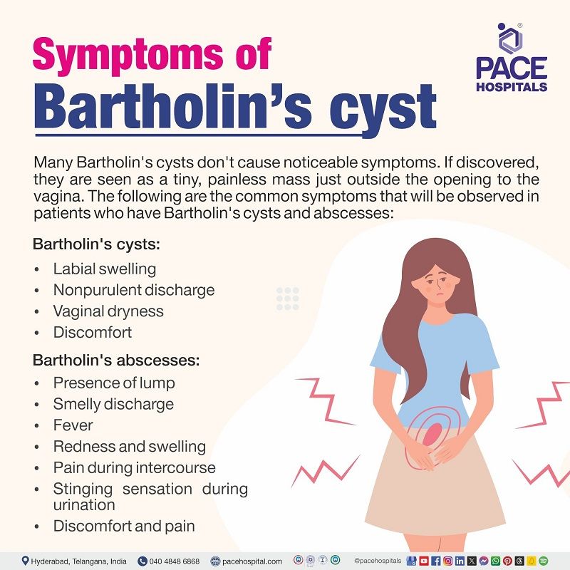 Symptoms of Bartholin's cyst Bartholin's cyst symptoms | Bartholin's gland cyst signs and symptoms | Symptoms of Bartholin's cyst | Visual depicting the symptoms of Bartholin's cyst