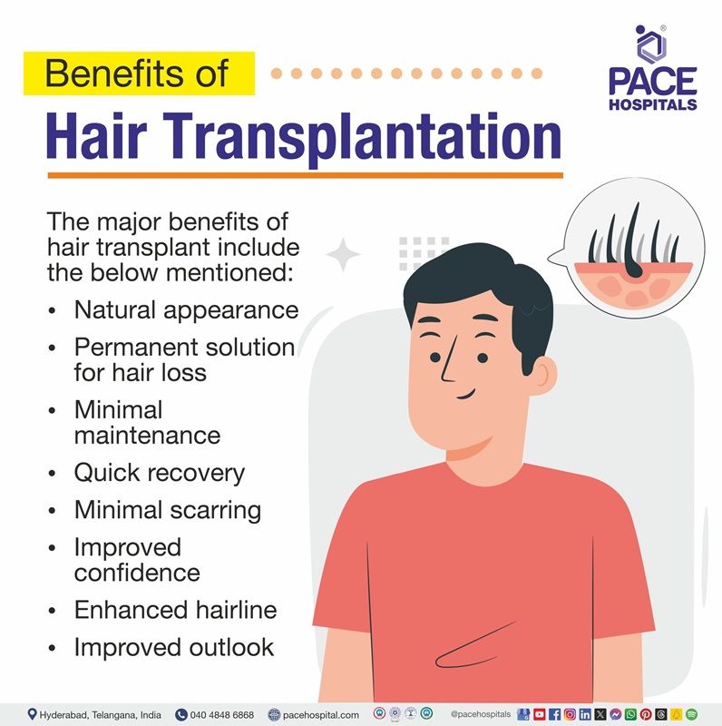 Hair transplant surgery benefits benefits of hair transplant | benefits of fue hair transplant | hair transplant benefits and side effects