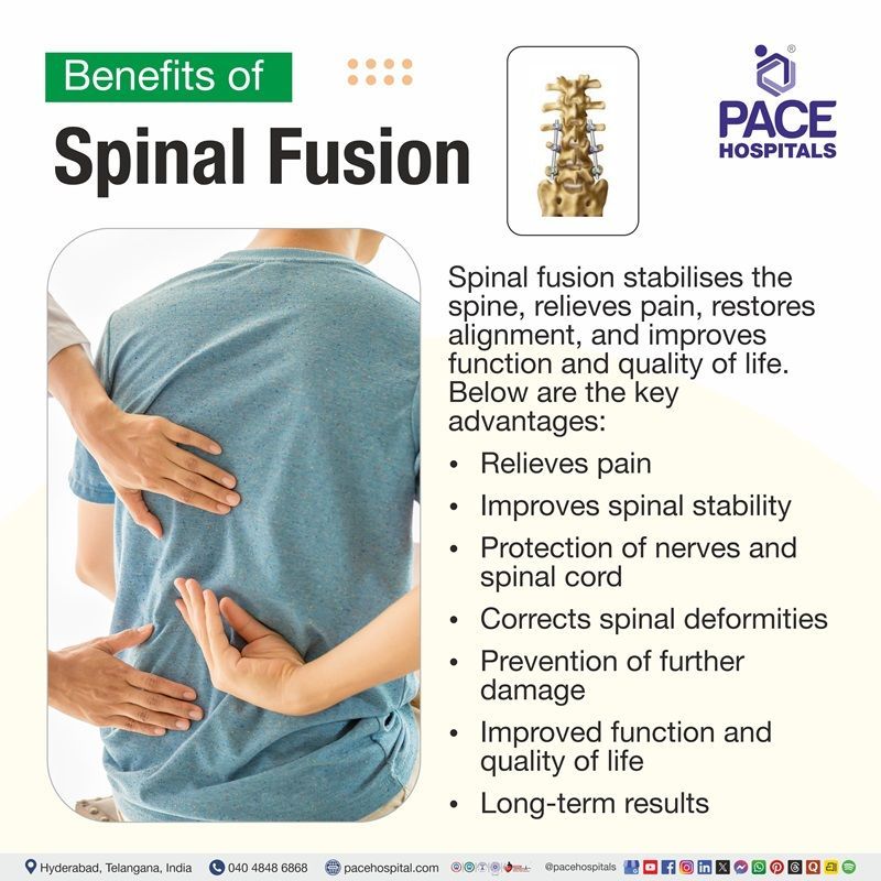Spinal Fusion Surgery Benefits Spinla Fusion surgery benefits | Advantages of spinal fusion surgery