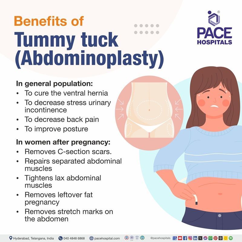 Benefits of tummy tuck (abdominoplasty) Surgery | Abdominoplasty benefits
