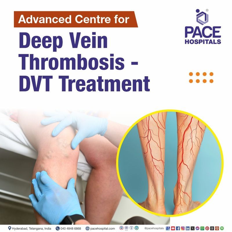 Best DVT Treatment Hospital in Hyderabad, Telangana Advanced center for DVT Treatment in Hyderabad, India | Top hospital for DVT treatment in Telangana