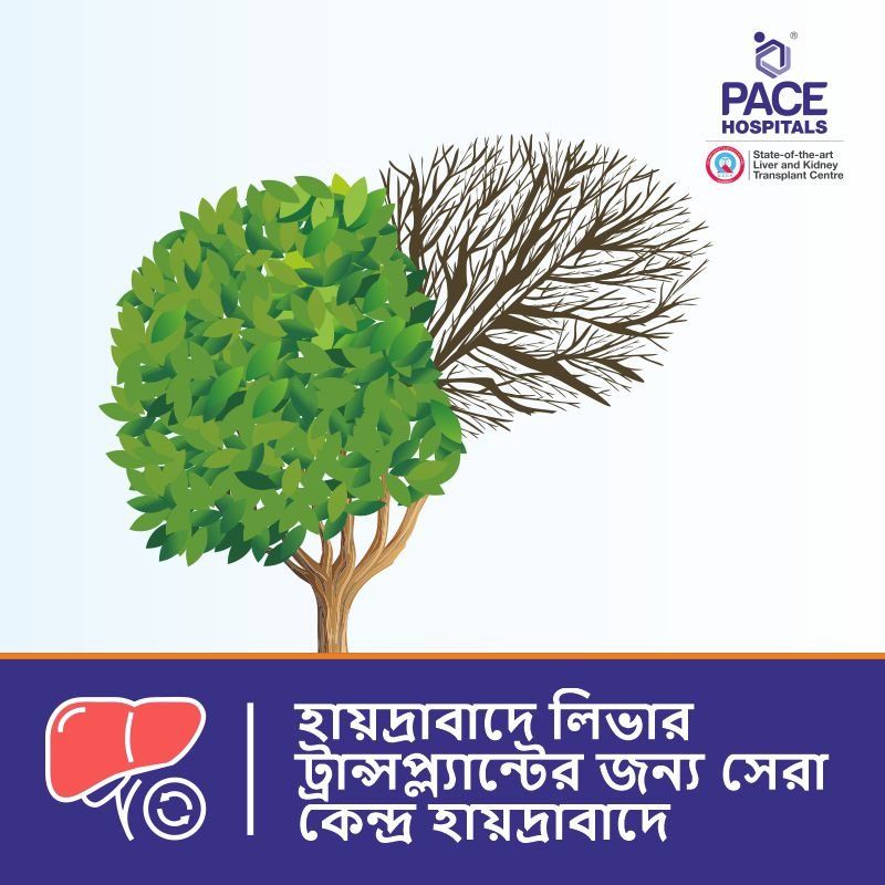 Best Centre for Liver Transplant in Hyderabad, Telangana - Bengali Best Hospital for Liver transplant in Hyderabad | Liver Transplant Bangladesh