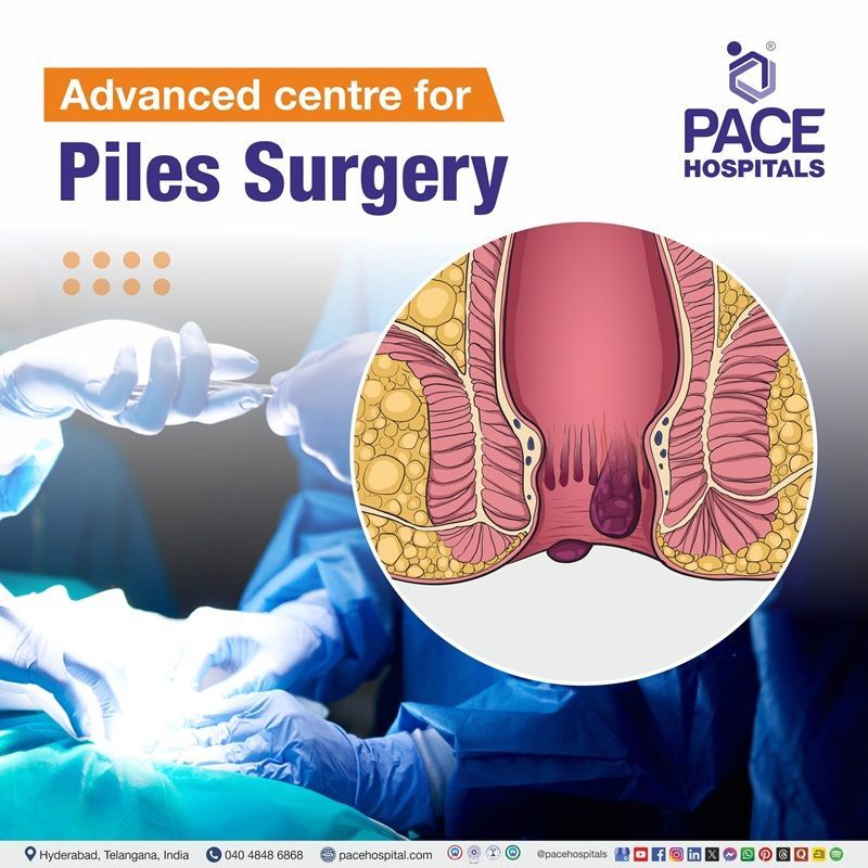 Advanced Centre for Piles Surgery in Hyderabad, India Best Hospital forPiles Surgery in Hyderabad | Advanced center for Piles operation in Hyderabad, India