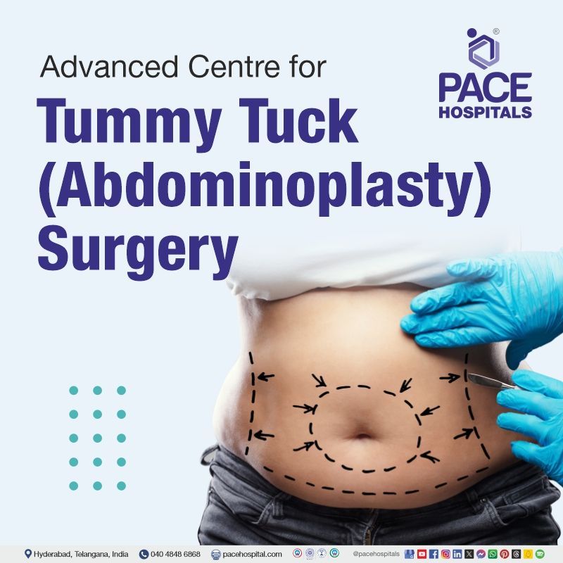 Advanced Centre for Tummy Tuck (Abdominoplasty) Surgery in Hyderabad, India best abdominoplasty surgery in Hyderabad | Tummy tuck surgery cost in Hyderabad, India | best tummy tuck treatment in Hyderabad | tummy tuck near me | abdominoplasty before and after