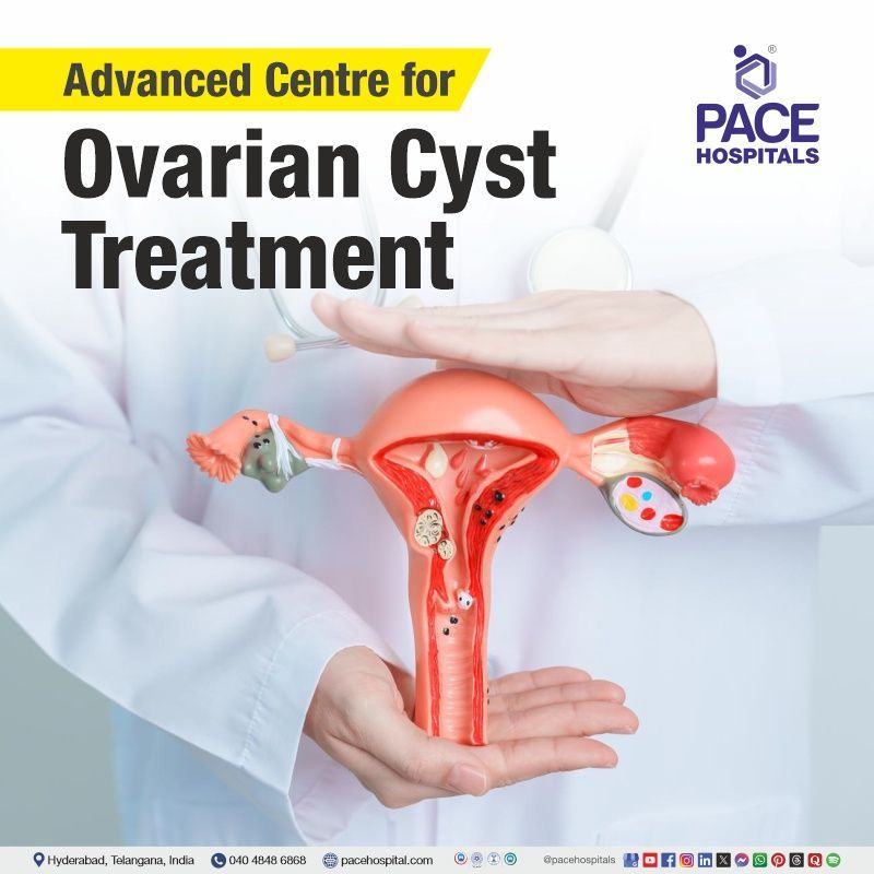 Best Hospital for Ovarian Cyst Treatment in Hyderabad, Telangana, India Best Hospital in Hyderabad for Ovarian Cyst Surgery | Best Ovarian Cyst Treatment in Hyderabad
