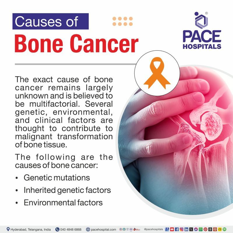 Bone Cancer Causes Bone Cancer Causes | What causes bone cancer | Causes of bone cancer