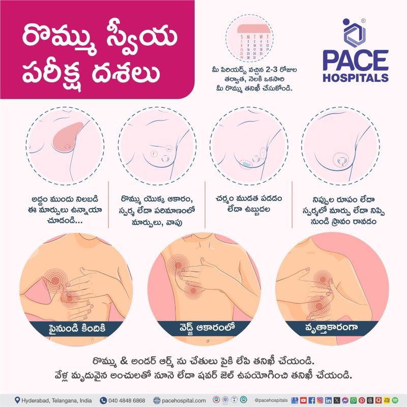 Breast Self Examinations Steps in Telugu | రొమ్ము స్వీయ పరీక్ష దశలు | Self examination of breast cancer in Telugu