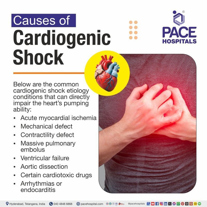 Cardiogenic Shock Causes Cardiogenic Shock Causes | what causes cardiogenic shock | common cause of cardiogenic shock | Most common cause of cardiogenic shock